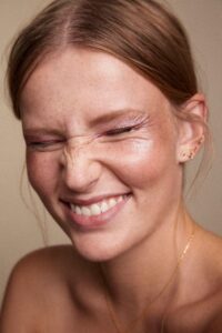 BOTOX