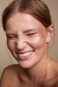 BOTOX