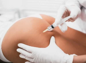 Bioestimuladores de colágeno