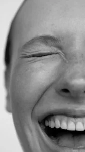 Botox