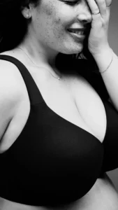 Mamoplastia Redutora